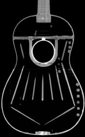 Röntgrnaufnahme- hell zentral der Tornavoz